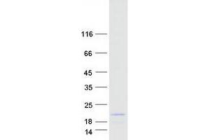 Western Blotting (WB) image for RNA Binding Motif Protein 38 (RBM38) (Transcript Variant 2) protein (Myc-DYKDDDDK Tag) (ABIN2730614)