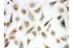 Immunohistochemistry (IHC) image for anti-Surfactant Protein D (SFTPD) (AA 292-321), (C-Term) antibody (ABIN3043335)