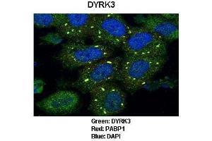 Sample Type :  HeLa cells   Primary Antibody Dilution :   1:50   Secondary Antibody :  Gaot anti-rabbit-Alexa Fluor   Secondary Antibody Dilution :   1:250   Color/Signal Descriptions :  Green: DYRK3 Red: PABP1 Blue: DAPI  Gene Name :  DYRK3  Submitted by :  Frank Wippich, Institute of Molecular Life Sciences, University of Zurich