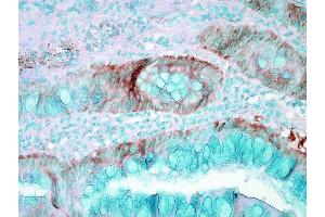Immunohistochemistry (IHC) image for anti-Heat Shock Protein 70 (HSP70) antibody (ABIN361821)