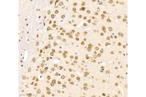 Immunohistochemistry of paraffin embedded mouse brain using neun (ABIN7075479) at dilution of 1: 500 (300x lens) (NeuN antibody)