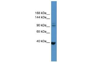 WB Suggested Anti-LTK Antibody Titration: 0. (LTK antibody  (N-Term))