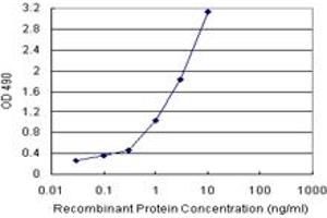 ADA (Human) Matched Antibody Pair