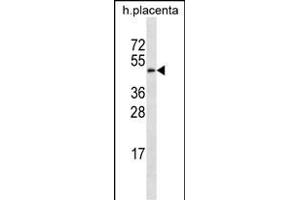 GAL3ST4 Antibody (Center) (ABIN656917 and ABIN2846112) western blot analysis in human placenta tissue lysates (35 μg/lane). (GAL3ST4 antibody  (AA 201-230))