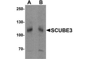 Western blot analysis of SCUBE3 in mouse kidney tissue lysate with SCUBE3 Antibody  at (A) 1 and (B) 2 μg/mL. (SCUBE3 antibody  (Middle Region))