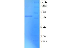 Death-Associated Protein (DAP) (AA 2-102), (full length) protein (GST tag) (DAP Protein (AA 2-102, full length) (GST tag))