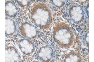Immunohistochemistry (IHC) image for anti-C-Reactive Protein (CRP) (AA 17-224) antibody (ABIN7442345)