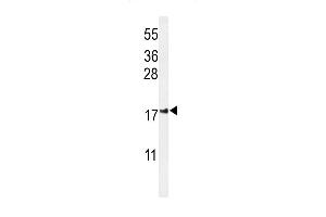 Western blot analysis of IL Antibody (Center) (ABIN653951 and ABIN2843173) in Jurkat cell line lysates (35 μg/lane). (IMMP2L antibody  (AA 81-109))