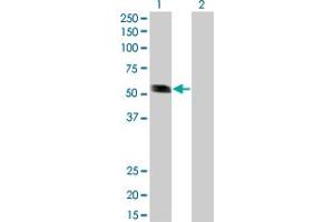 Western Blot analysis of RING1 expression in transfected 293T cell line by RING1 monoclonal antibody (M01), clone 3G6. (RING1 antibody  (AA 81-170))