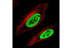 Immunofluorescent staining of HeLa cells with FUS monoclonal antibody, clone CL0190  (Green) shows clear nuclear (without nucleoli). (FUS antibody)