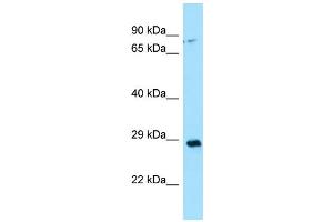 WB Suggested Anti-CA13 Antibody Titration: 1. (CA13 antibody  (N-Term))