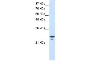 Western Blotting (WB) image for anti-Transcription Factor A, Mitochondrial (TFAM) (N-Term) antibody (ABIN2777277)