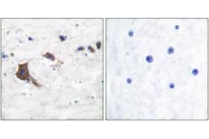Immunohistochemistry analysis of paraffin-embedded human brain tissue, using ERAB Antibody. (HSD17B10 antibody  (AA 111-160))
