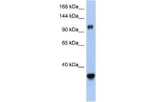 XPO5 antibody used at 0. (XPO5 antibody  (Middle Region))