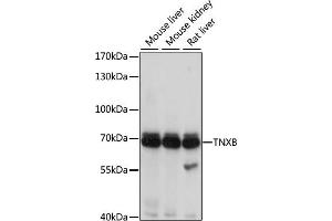 Western blot analysis of extracts of various cell lines, using TNXB antibody (ABIN3016209, ABIN3016210, ABIN3016211 and ABIN6219624) at 1:1000 dilution. (TNXB antibody  (AA 444-673))