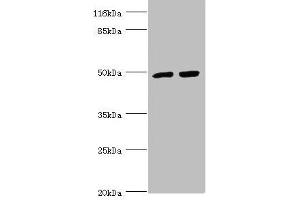 Western blot All lanes: TRIM13 antibody at 1. (TRIM13 antibody  (AA 40-310))
