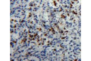 IHC-P analysis of spleen tissue, with DAB staining. (HPSE antibody  (AA 27-101))