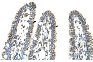 Human Intestine (CPS1 antibody  (Middle Region))