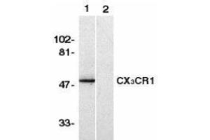 Western Blotting (WB) image for anti-Chemokine (C-X3-C Motif) Receptor 1 (CX3CR1) (AA 2-21), (N-Term) antibody (ABIN2473128) (CX3CR1 antibody  (N-Term))