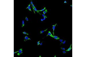 IF analysis of CHAT using anti-CHAT antibody (ABIN7600920). (Choline Acetyltransferase antibody  (AA 25-731))