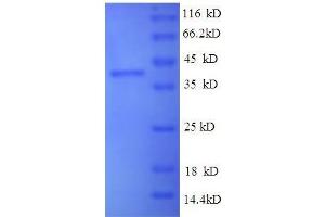 Vascular Endothelial Growth Factor C (VEGFC) (AA 112-227), (full length) protein (GST tag)