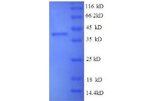 SDS-PAGE (SDS) image for Vascular Endothelial Growth Factor C (VEGFC) (AA 112-227), (full length) protein (GST tag) (ABIN1095811)