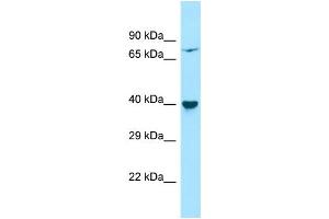 Host: Rabbit Target Name: PPM1L Sample Type: HepG2 Whole Cell lysates Antibody Dilution: 1. (PPM1L antibody  (Middle Region))