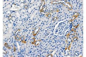 ABIN6264573 and ABIN6278624 at 1/100 staining Rat kidney tissue by IHC-P.