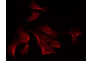 ABIN6275617 staining HuvEc by IF/ICC. (SYT13 antibody  (Internal Region))