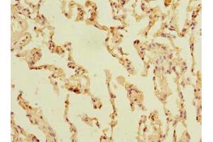 Immunohistochemistry of paraffin-embedded human lung tissue using ABIN7170179 at dilution of 1:100 (SLC23A3 antibody  (AA 391-492))