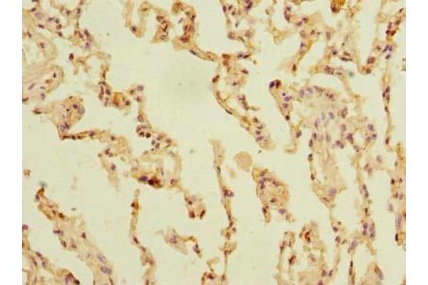 SLC23A3 antibody  (AA 391-492)