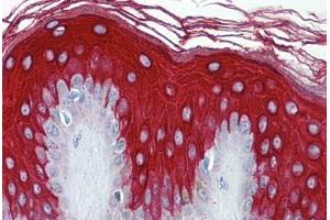 Human Skin: Formalin-Fixed, Paraffin-Embedded (FFPE) (Cytokeratin 19 antibody  (N-Term))