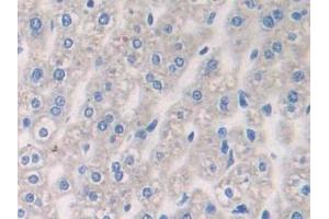 Immunohistochemistry (IHC) image for anti-alpha-2-HS-Glycoprotein (AHSG) (AA 19-250) antibody (ABIN7429511)
