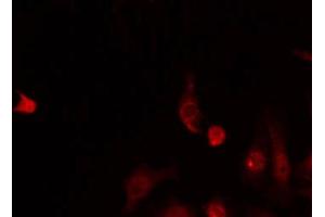 ABIN6268800 staining HeLa by IF/ICC. (BUB3 antibody  (C-Term))