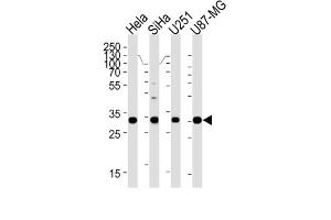 Western Blotting (WB) image for anti-Homeobox B2 (HOXB2) antibody (ABIN3004768)