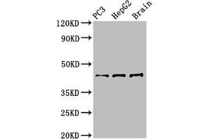 Western Blot Positive WB detected in: PC-3 whole cell lysate, HepG2 whole cell lysate, Mouse brain tissue All lanes: STAC antibody at 3 μg/mL Secondary Goat polyclonal to rabbit IgG at 1/50000 dilution Predicted band size: 45 kDa Observed band size: 45 kDa (STAC antibody  (AA 1-119))