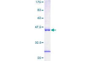 ACAT1 Protein (AA 16-162) (GST tag)