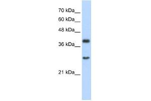 WB Suggested Anti-WDR39 Antibody Titration:  2. (CIAO1 antibody  (C-Term))