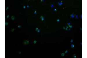 Immunofluorescence staining of MCF-7 cells with ABIN7139980 at 1:100, counter-stained with DAPI. (OR2M2 antibody  (AA 259-273))