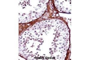 Immunohistochemistry (IHC) image for anti-T-Box 5 (TBX5) antibody (ABIN2998161)