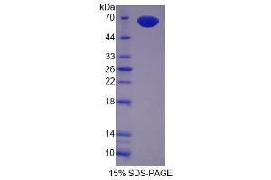 SDS-PAGE analysis of Mouse Pregnancy Zone Protein.
