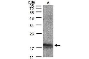 WB Image Sample(30 μg of whole cell lysate) A:293T 12% SDS PAGE antibody diluted at 1:1500 (MANF antibody)