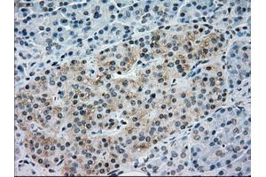 Immunohistochemical staining of paraffin-embedded Ovary tissue using anti-NRBP1mouse monoclonal antibody. (NRBP1 antibody)