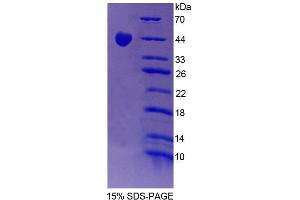 SDS-PAGE (SDS) image for TROVE Domain Family, Member 2 (TROVE2) (AA 16-376) protein (His tag) (ABIN4989768)
