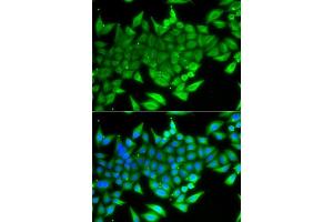 Immunofluorescence analysis of A549 cells using TTF2 antibody (ABIN5975177). (TTF2 antibody)