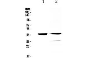 Western blot analysis of Cathepsin D using anti-Cathepsin D antibody . (Cathepsin D antibody  (AA 161-358))