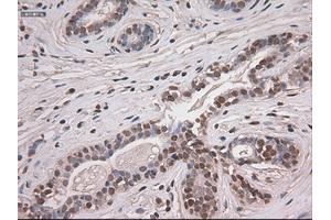 Immunohistochemical staining of paraffin-embedded breast tissue using anti-NOTCH1 mouse monoclonal antibody. (Notch1 antibody  (AA 2300-2556))