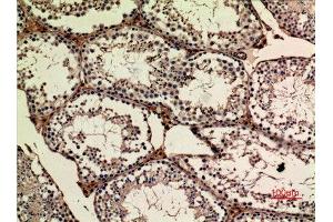 Immunohistochemistry (IHC) analysis of paraffin-embedded Mouse Ovary, antibody was diluted at 1:100.
