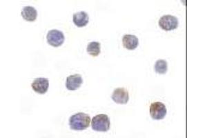 Immunocytochemical staining of DRAK2 in Jurkat cells with DRAK2 antibody at 10μg/ml. (DRAK2 antibody  (AA 351-365))