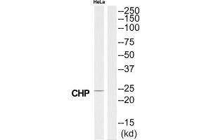 Western Blotting (WB) image for anti-Calcium Binding Protein P22 (CHP) (N-Term) antibody (ABIN1850960) (CHP antibody  (N-Term))